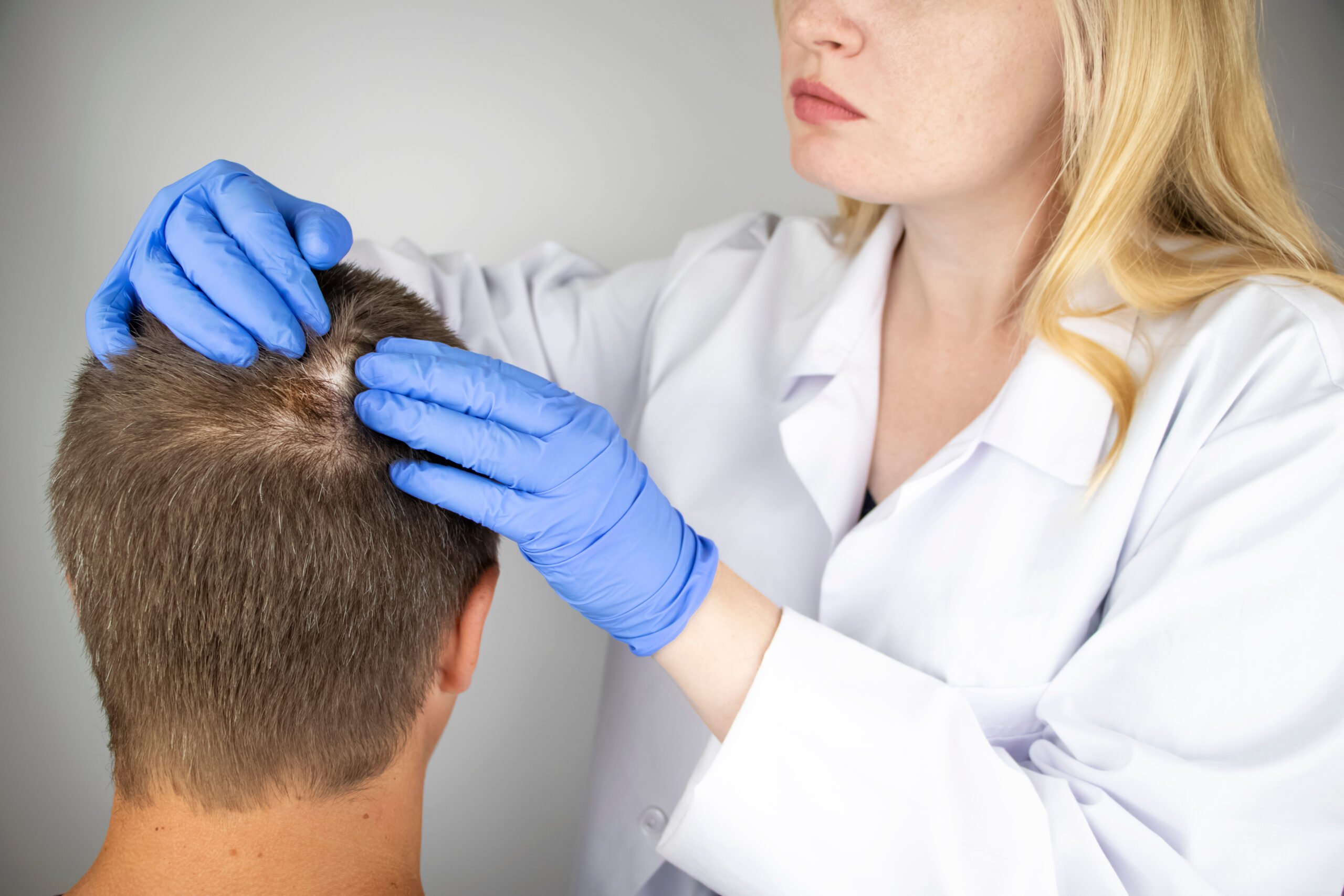 Red Light Therapy for Hair Growth